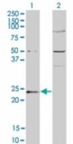 GUK1 Antibody in Western Blot (WB)