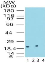 DUSP18 Antibody in Western Blot (WB)