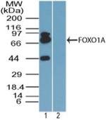 FOXO1 Polyclonal Antibody