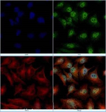 Sorcin Polyclonal Antibody