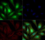 ROR gamma Polyclonal Antibody