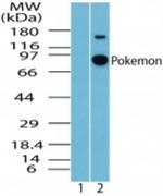 Pokemon Antibody in Western Blot (WB)