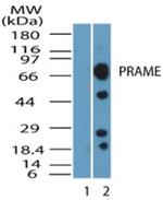 PRAME Antibody in Western Blot (WB)