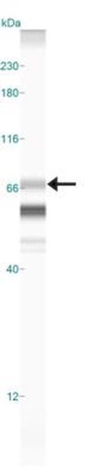 PRAME Antibody in Western Blot (WB)