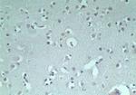 RNF128 Polyclonal Antibody