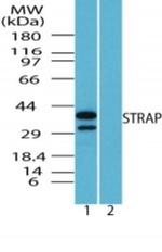 STRAP Antibody in Western Blot (WB)