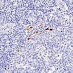 FOXP3 Polyclonal Antibody