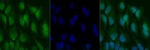 NFkB p65 Polyclonal Antibody