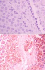 HIPK3 Antibody in Immunohistochemistry (Paraffin) (IHC (P))