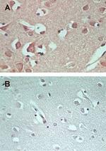 AMPD1 Antibody in Immunohistochemistry (IHC)