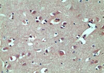 TRBP Polyclonal Antibody