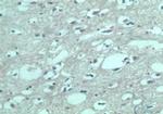 EDG8 Polyclonal Antibody