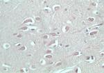EDG8 Antibody in Immunohistochemistry (Paraffin) (IHC (P))