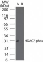 Phospho-HDAC7 (Ser155) Polyclonal Antibody