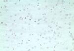 ARHGAP20 Polyclonal Antibody