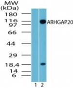 ARHGAP20 Antibody in Western Blot (WB)