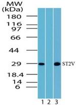 ST2 Polyclonal Antibody
