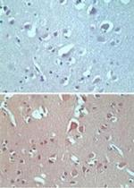 VANGL2 Polyclonal Antibody