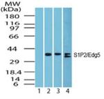 S1PR2 Polyclonal Antibody