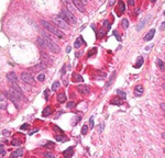 AMBRA1 Antibody in Immunohistochemistry (Paraffin) (IHC (P))