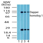 DACT1 Antibody in Western Blot (WB)