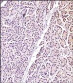 RGS5 Antibody in Immunohistochemistry (Paraffin) (IHC (P))