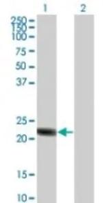 RGS5 Antibody in Western Blot (WB)