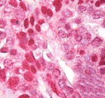 CNOT4 Polyclonal Antibody