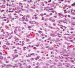 SWAP70 Polyclonal Antibody