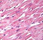 EPM2A Polyclonal Antibody