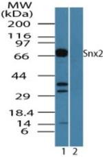 SNX2 Polyclonal Antibody