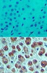 eIF4A1 Polyclonal Antibody