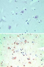 SNX2 Polyclonal Antibody