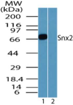 SNX2 Antibody in Western Blot (WB)