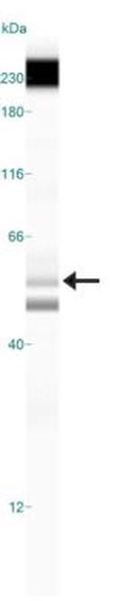 TIP60 Antibody in Western Blot (WB)