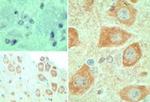 EBI3 Polyclonal Antibody