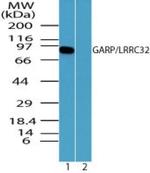 GARP Polyclonal Antibody
