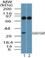 LY6G6D Antibody in Western Blot (WB)