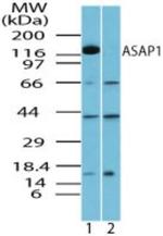 ASAP1 Polyclonal Antibody
