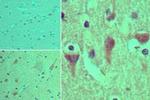 ASAP3 Polyclonal Antibody
