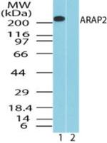 ARAP2 Antibody in Western Blot (WB)