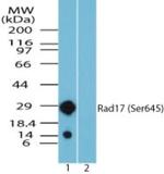 Phospho-RAD17 (Ser645) Antibody in Western Blot (WB)