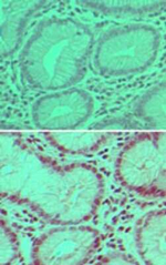 USP7 Polyclonal Antibody