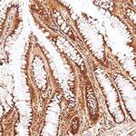 PLD2 Antibody in Immunohistochemistry (Paraffin) (IHC (P))