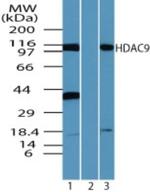 HDAC9 Polyclonal Antibody