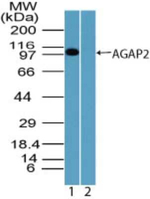 CENTG1 Antibody in Western Blot (WB)