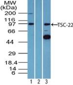 TSC22D1 Polyclonal Antibody