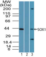 SOX1 Polyclonal Antibody