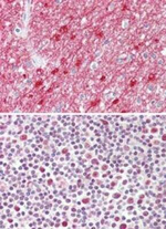 TCF19 Polyclonal Antibody