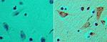 FLII Antibody in Immunohistochemistry (Paraffin) (IHC (P))